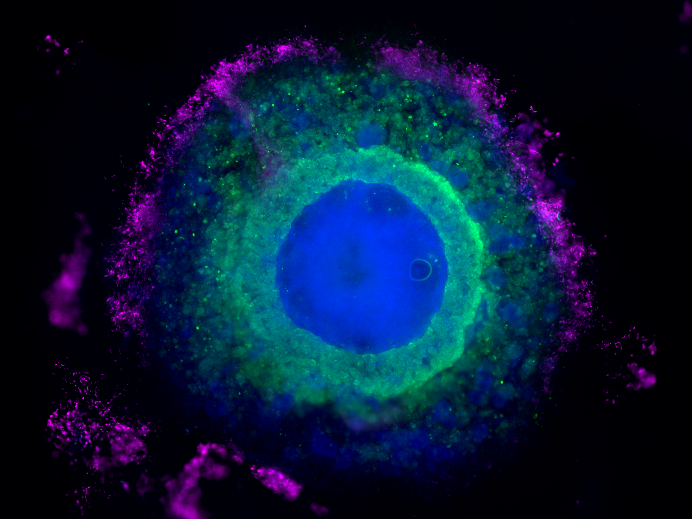 heart-forming organoids from human pluripotent stem cells