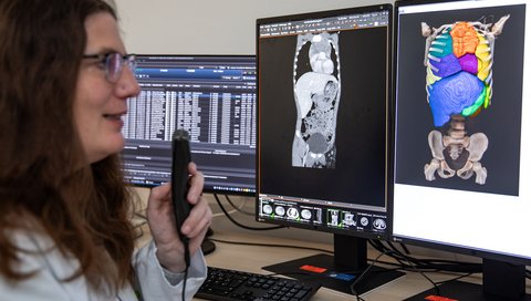 Professorin Dr. Diane Renz betrachtet CT-Bilder eines jugendlichen Patienten mit Non-Hodgkin-Lymphom.