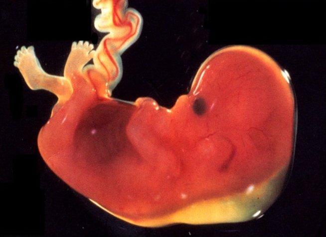 Bild von einem Embryo in der frühen Entwicklung auf einem schwarzen Hintergrund