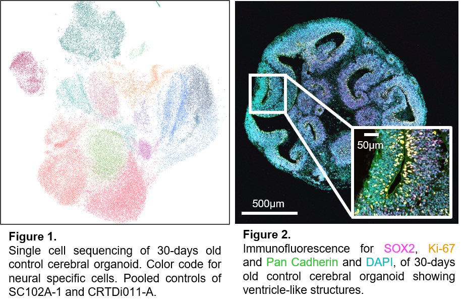 Single Cell Sequencing and Immunofluorescence of Cerebral Organoids.