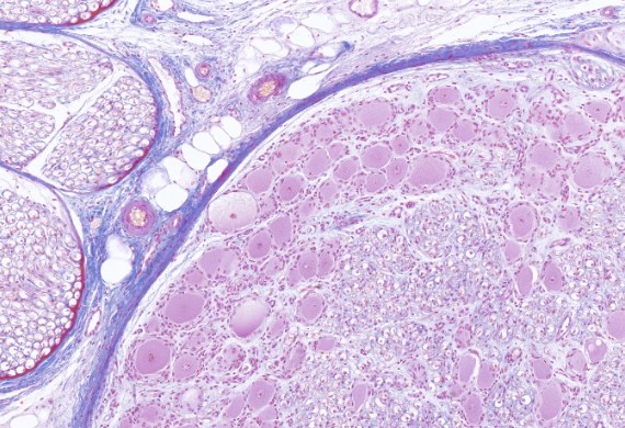 Spinalganglion mit MyMicroscope dargestellt, Copyright: MHH_ Institut für Neuroanatomie und Zellbiologie