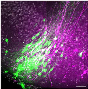 Copyright: Neuroanatomie und Zellbiologie, MHH